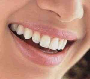 sonrisa.jpg sonrisa