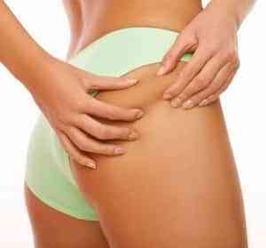 celulitis.jpg celulitis