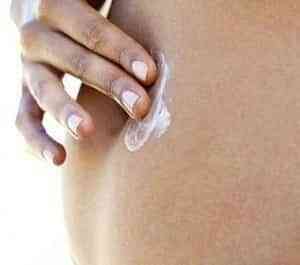 ¿Qué son las estrías? 1 estrias