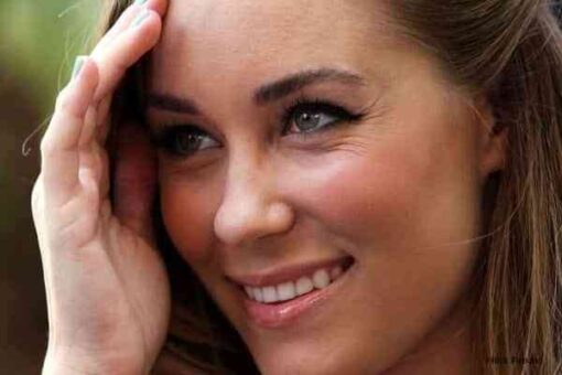 Eliminar patas de gallo 1 mujer