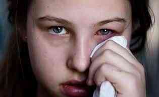 Consejo para evitar los ojos rojos 1 ojos rojos