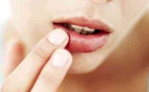 labios